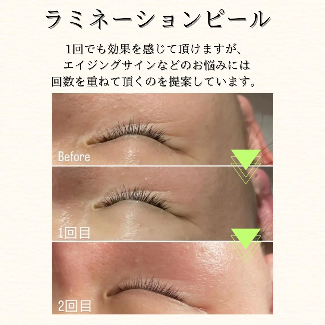 hue. 鷺田のエステ・リラクイメージ