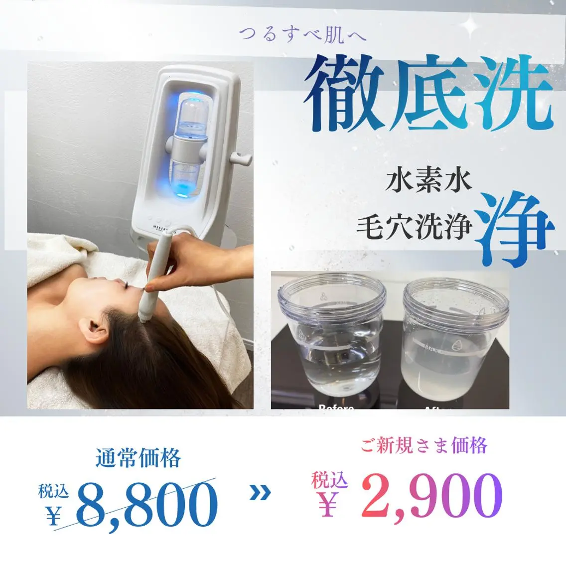 毛穴洗浄のみ‼️水素トルネード🌪️洗浄🫧頑固な黒ずみ・角栓スッキリ！つるスベ透明肌へ〈メンズも大歓迎〉の写真