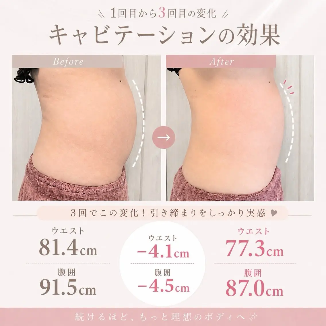 エステ GARNE’T ナカムラのエステ・リラクイメージ