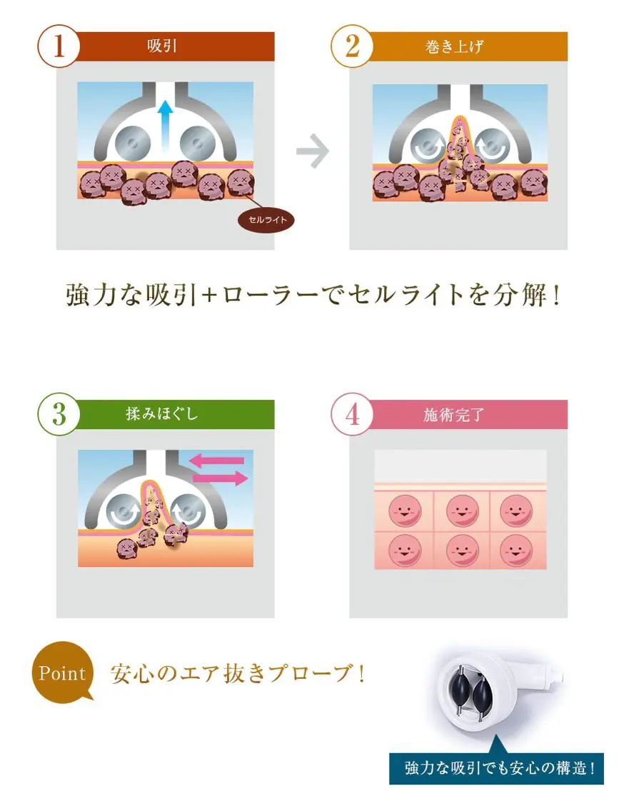【1箇所集中ケア】ハイパーシェイプ30分の写真