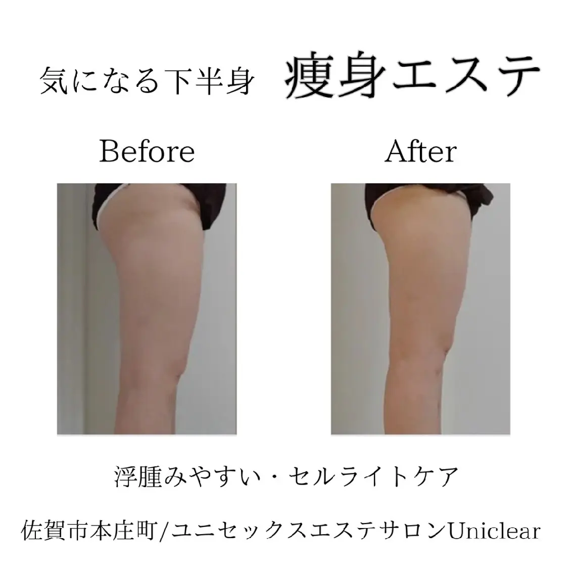 エステ リラク 佐賀│男女エステ ユニクリアのエステ・リラクイメージ