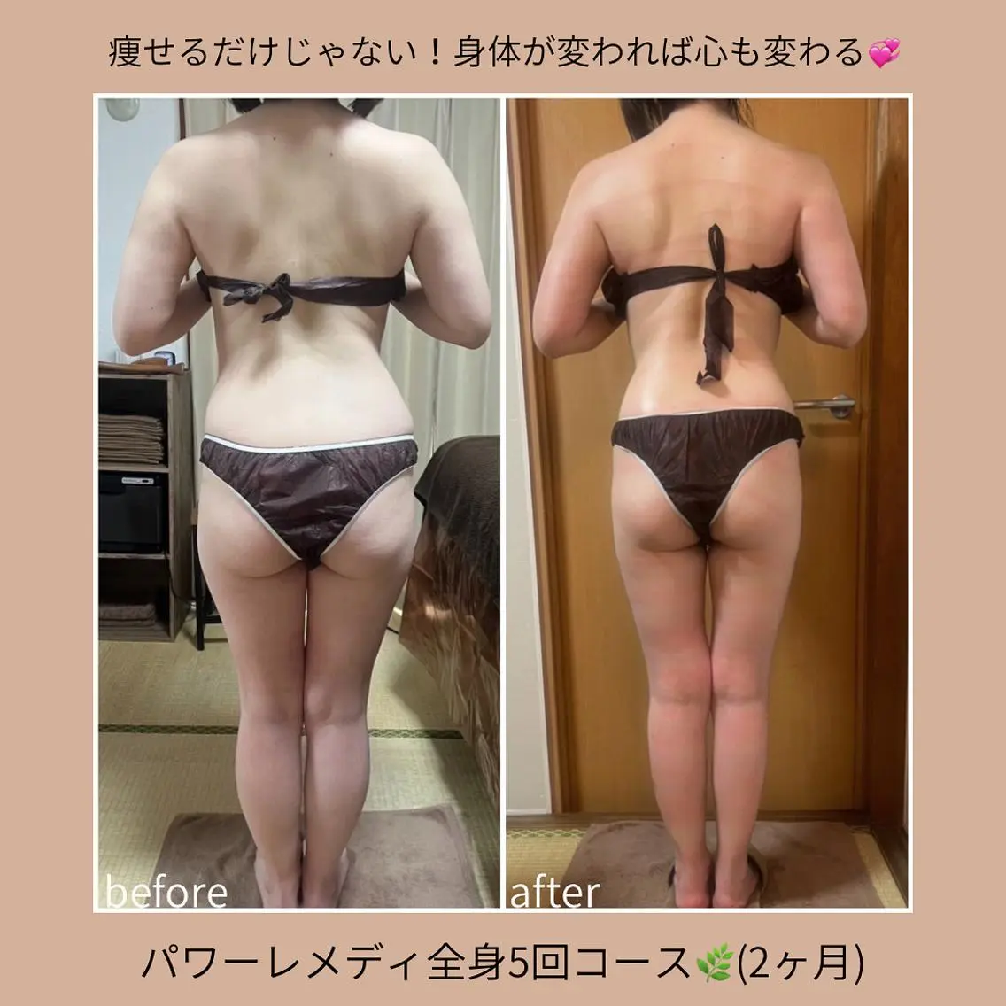 《本気痩せ×疲労改善 》 BILOOPのエステ・リラクイメージ