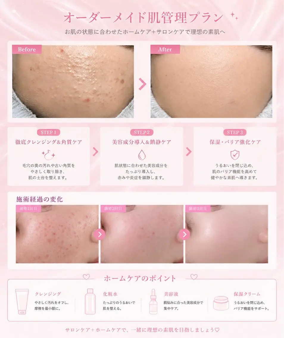 エステ LANTIA 肌改善ホワイトニングのその他イメージ