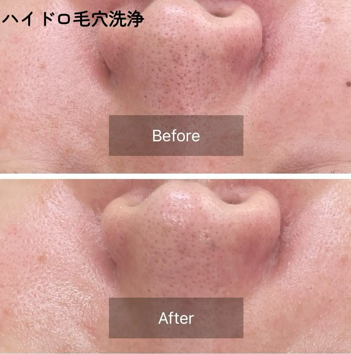 La・Luana Cocoroのエステ・リラクイメージ