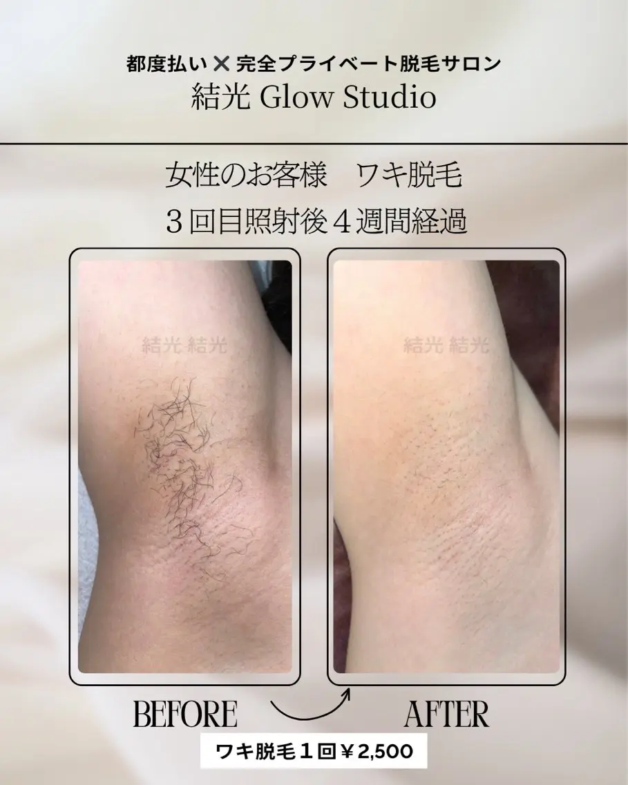 脱毛 結光Glow Studioのエステ・リラクイメージ