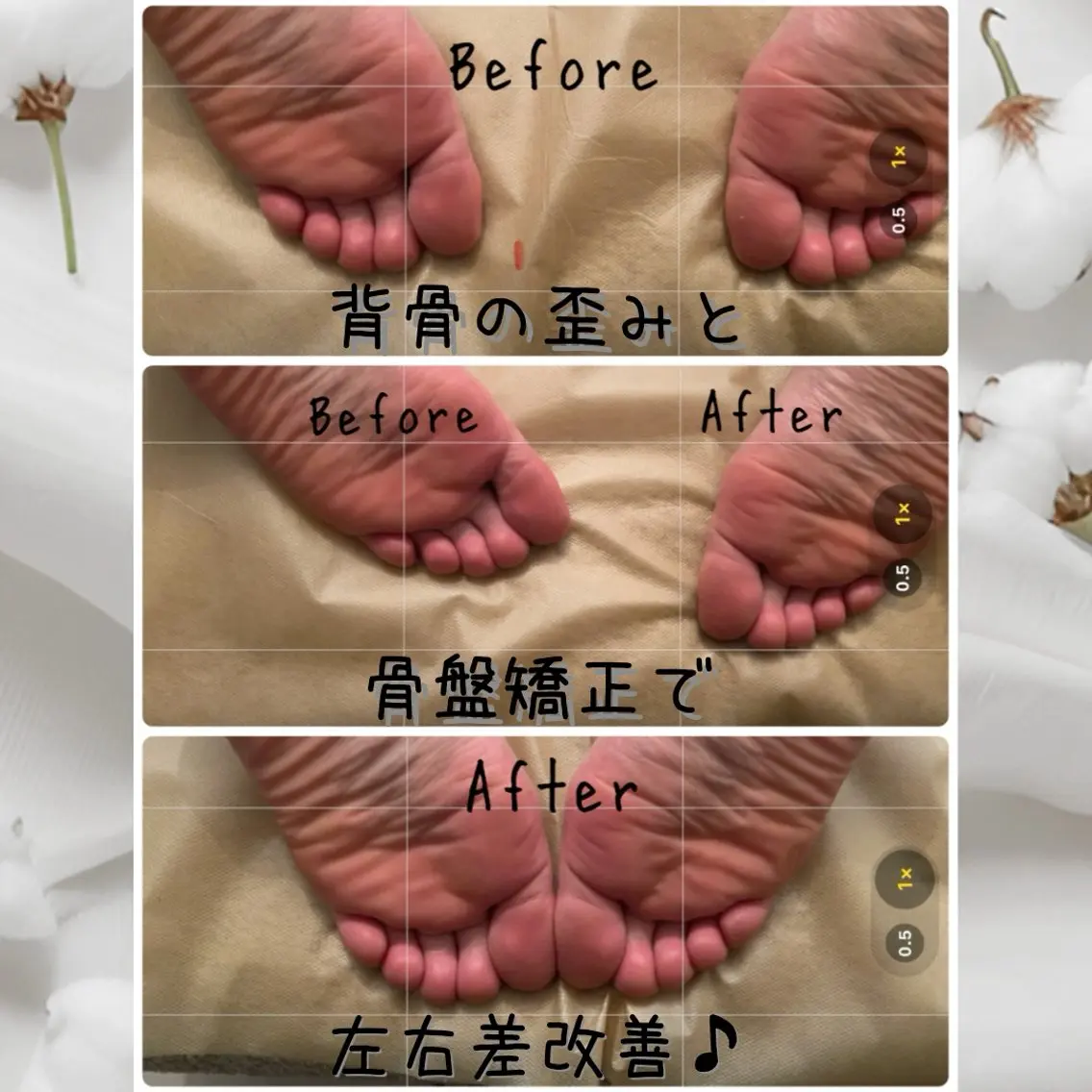 【🧍♀️パンパン足腰/腰痛改善に🧍♂️】背骨/骨盤矯正+アロマリンパマッサージ120分の写真