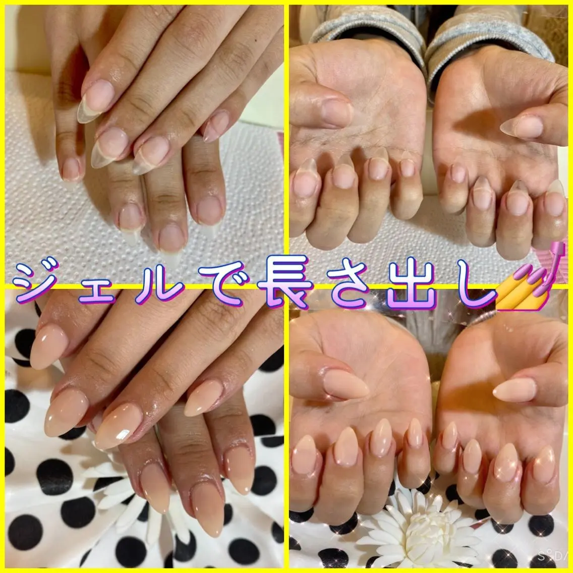 ネイル ♢ME2ROOM♢ #巻き爪#リラクのネイルデザイン