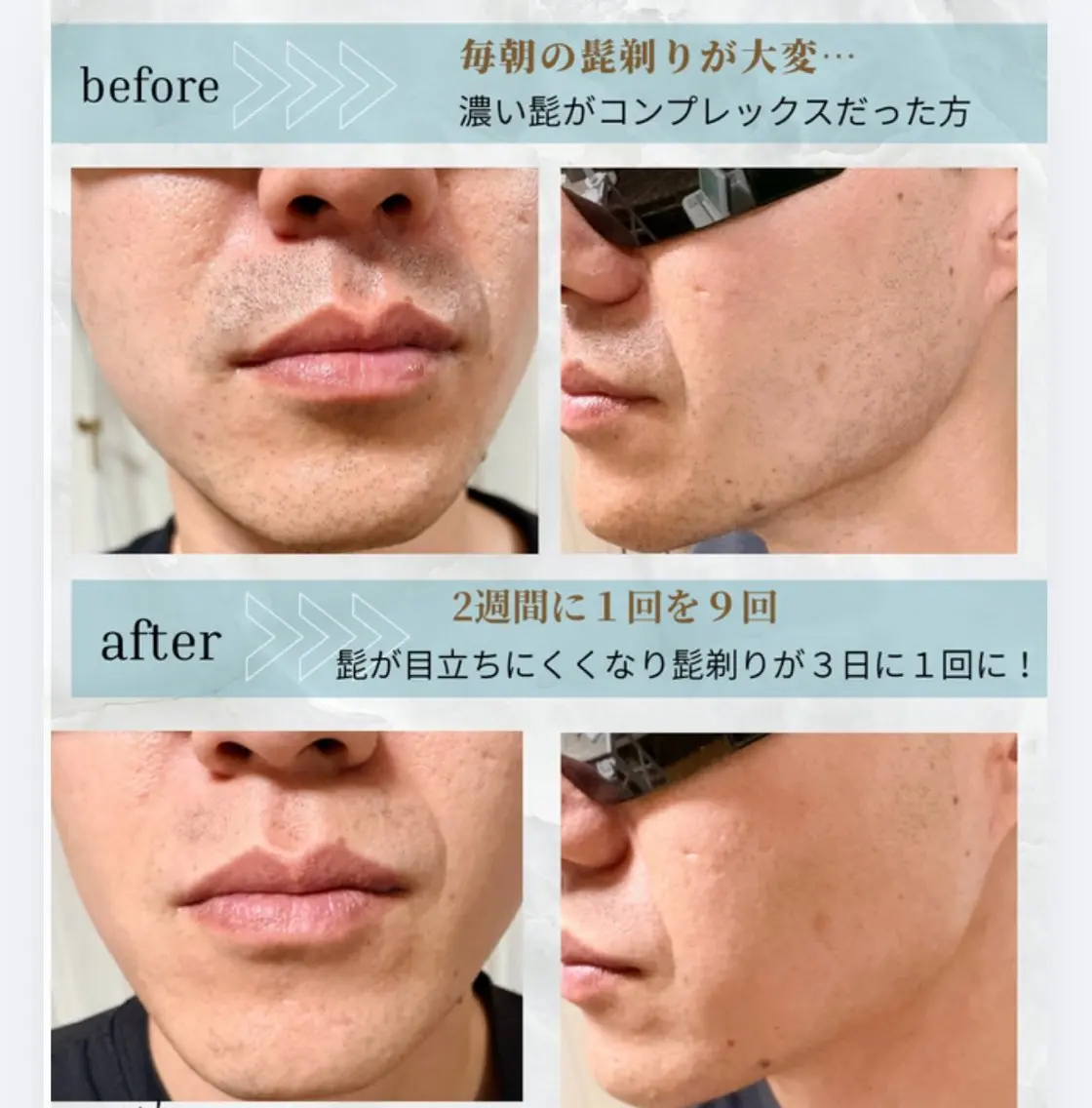 脱毛サロン moco selfのエステ・リラクイメージ