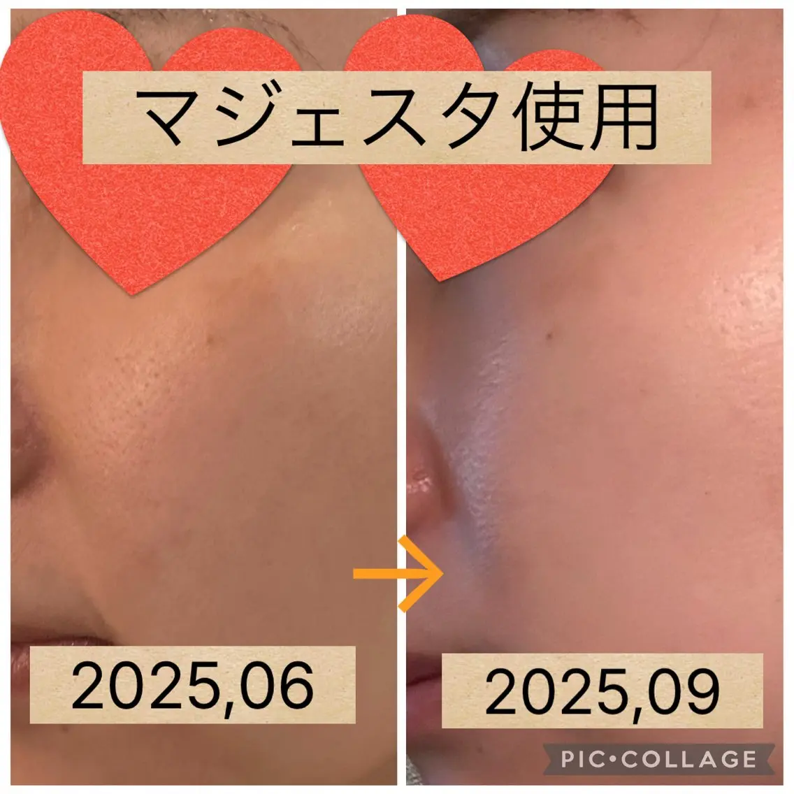 エイジング・小顔ケア Pure Lilyのエステ・リラクイメージ