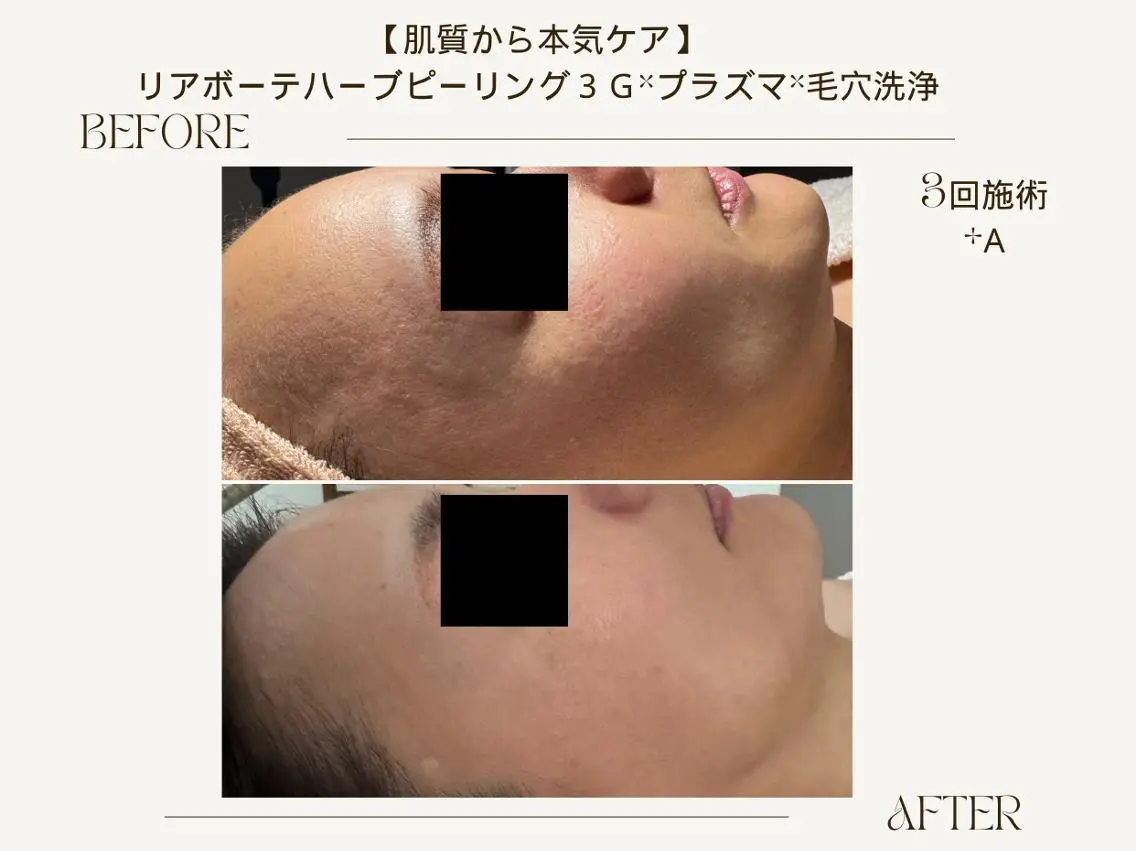 エステ ReCell 肌管理のエステ・リラクイメージ
