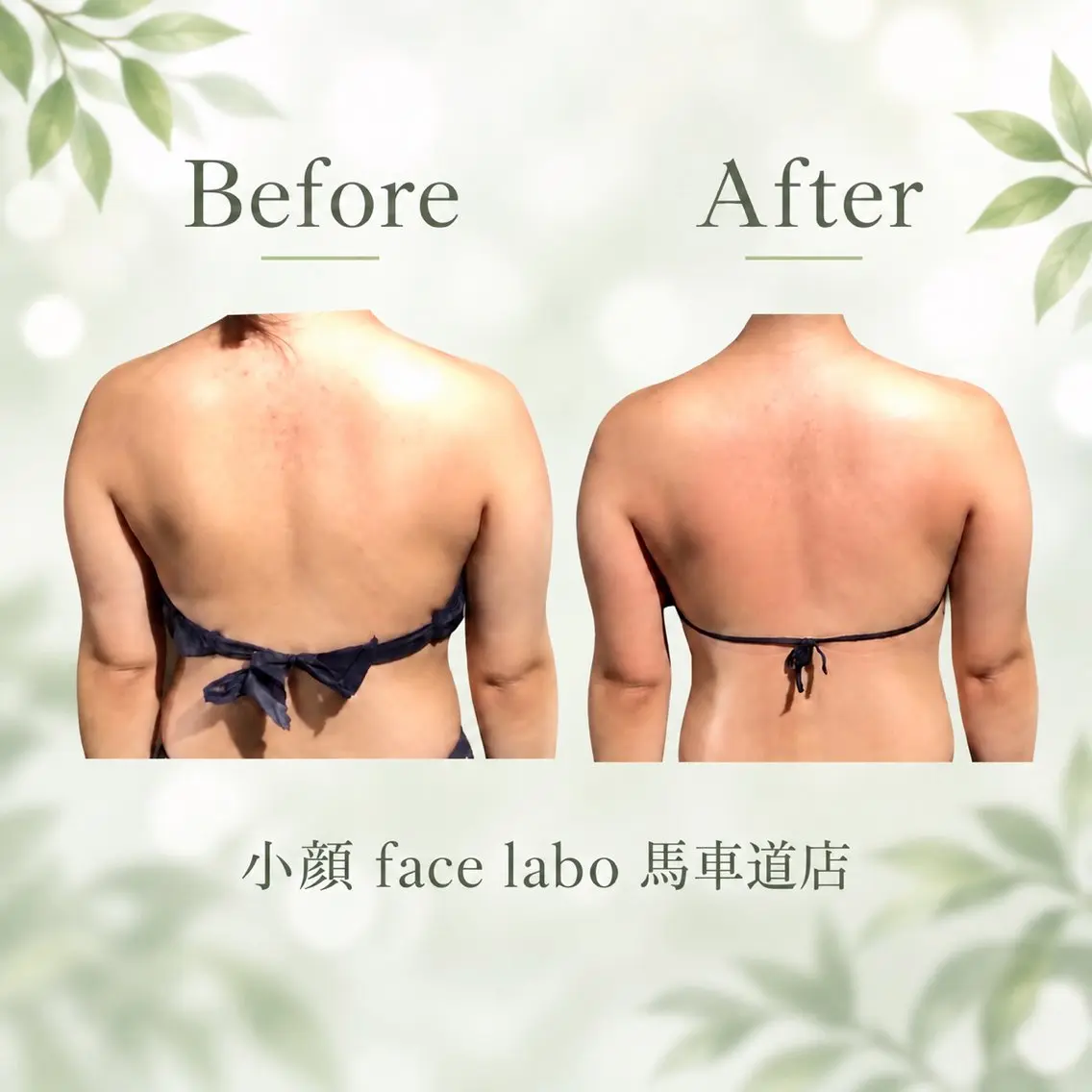 エステ リラク 小顔 facelaboのエステ・リラクイメージ