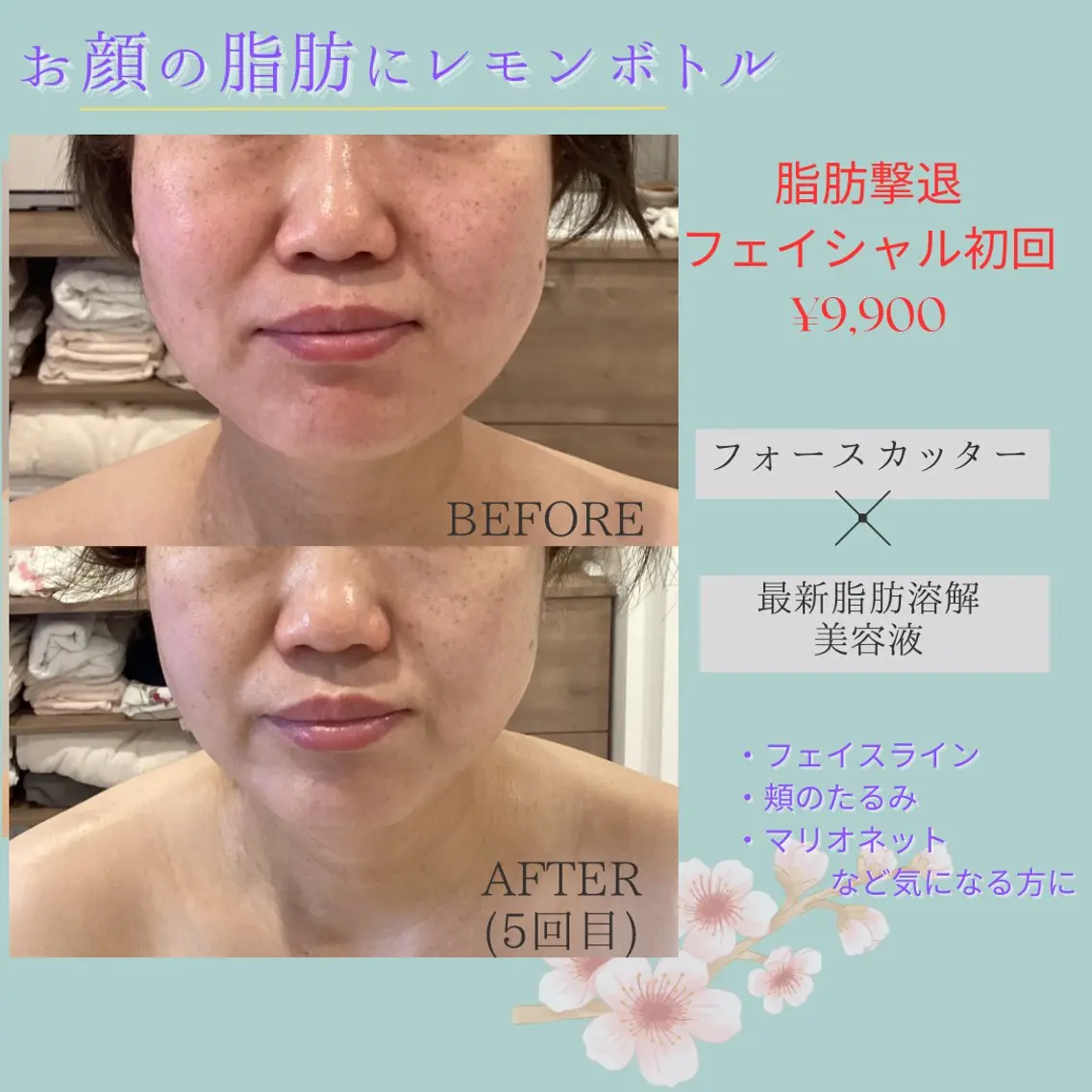 エステ segar 菅野枝里子のエステ・リラクイメージ