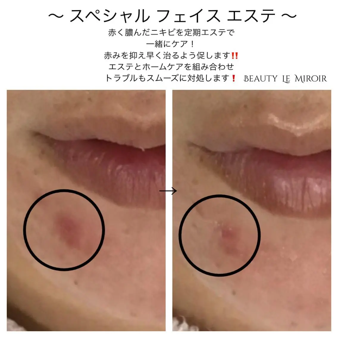 ビューティー ミロワールのエステ・リラクイメージ