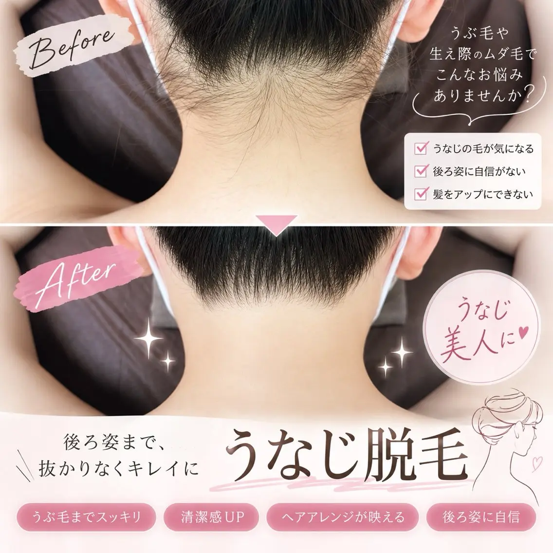 脱毛 totalsalon lienのエステ・リラクイメージ