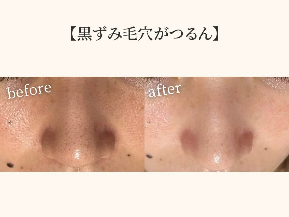 小顔矯正×毛穴サロン DRRAMSPA町田のエステ・リラクイメージ