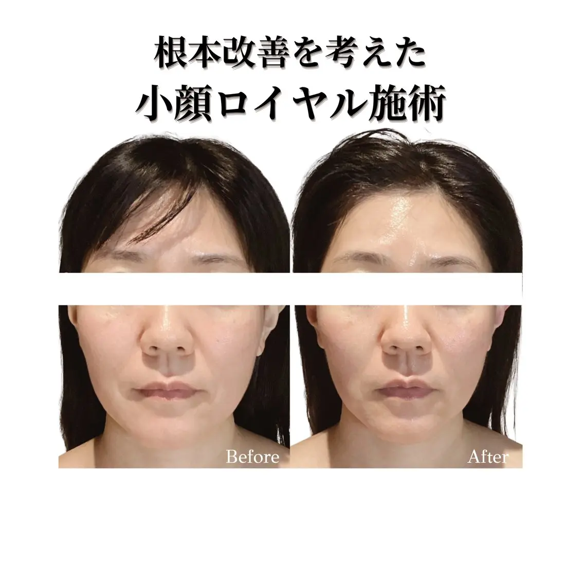 看護師 AYUIのエステ・リラクイメージ