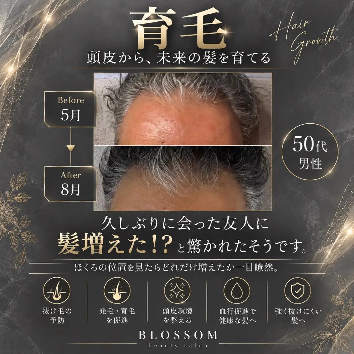 BLOSSOM 菊地のその他イメージ