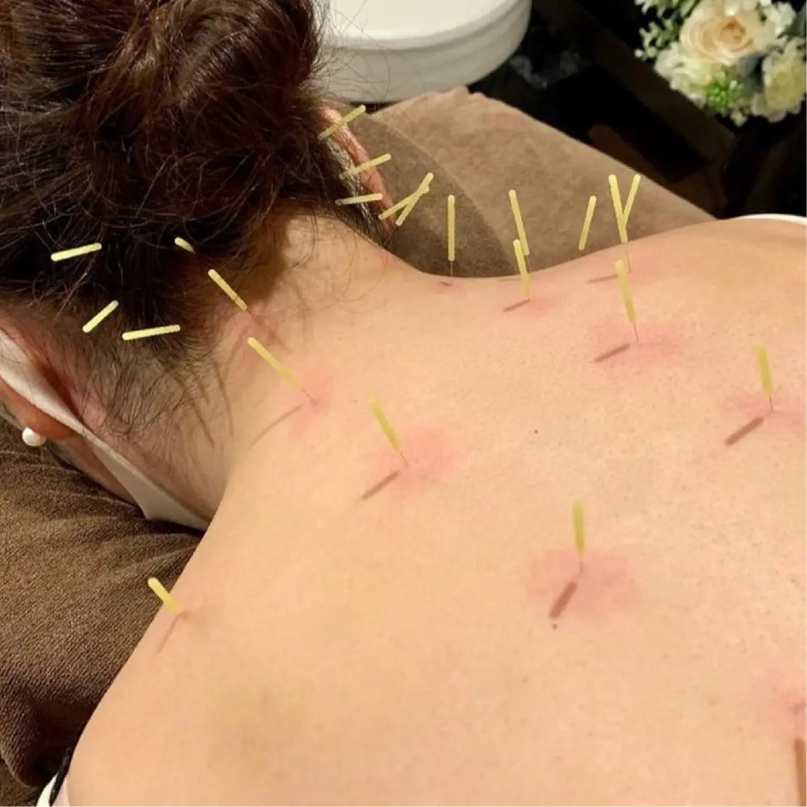 【モニター特別価格📣鍼灸Body】ほぐして流して整える🌠血巡りリンパ+BODY鍼灸💆♀️首肩こり・自律神経・腰痛の写真
