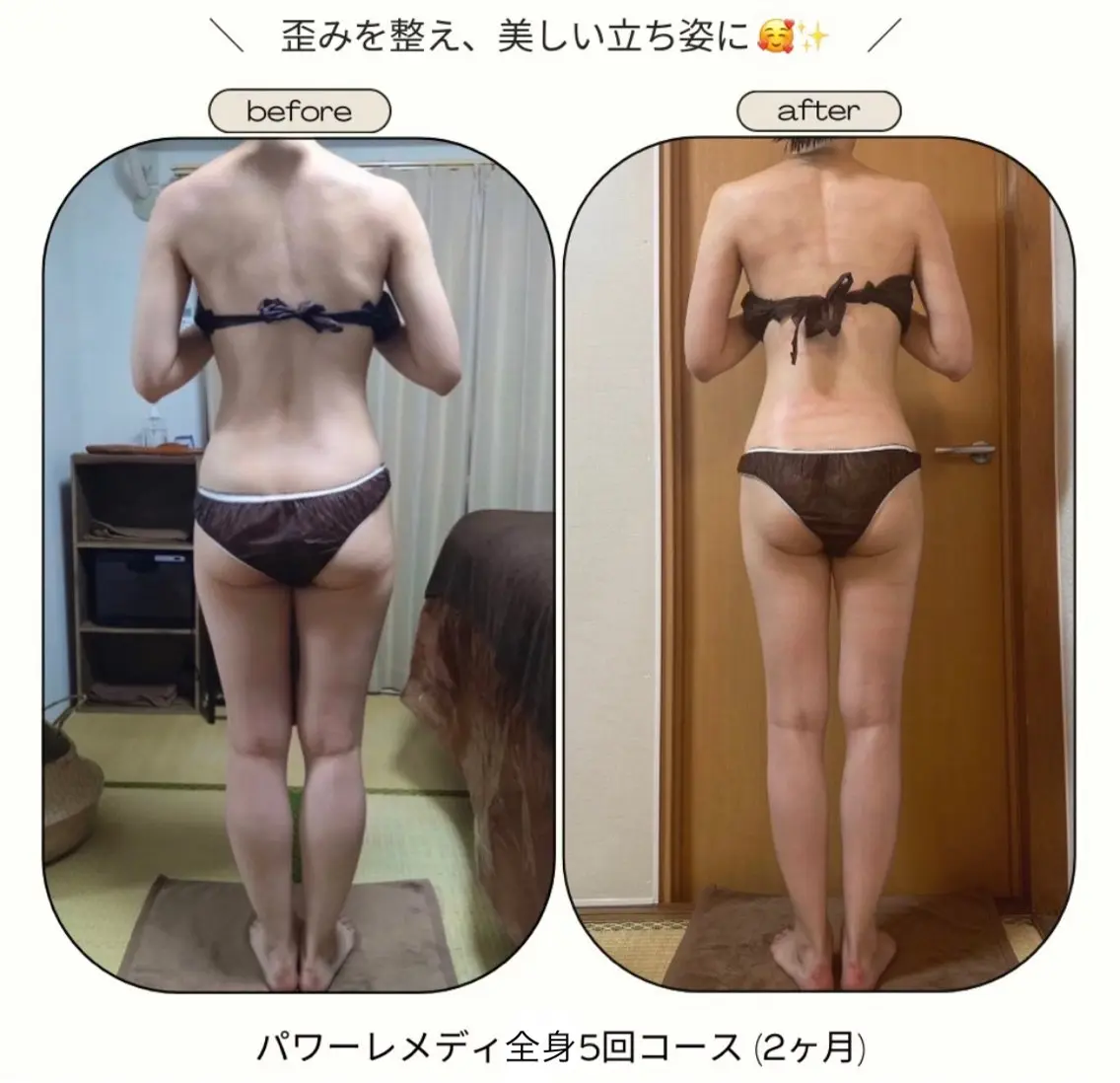 《本気痩せ×疲労改善 》  BILOOPのエステ・リラクイメージ