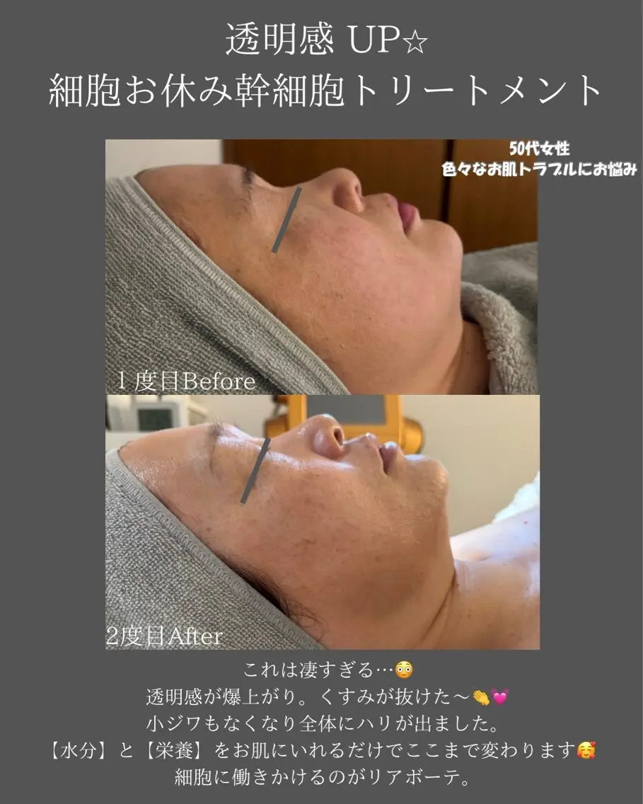 BLOSSOM 菊地のエステ・リラクイメージ