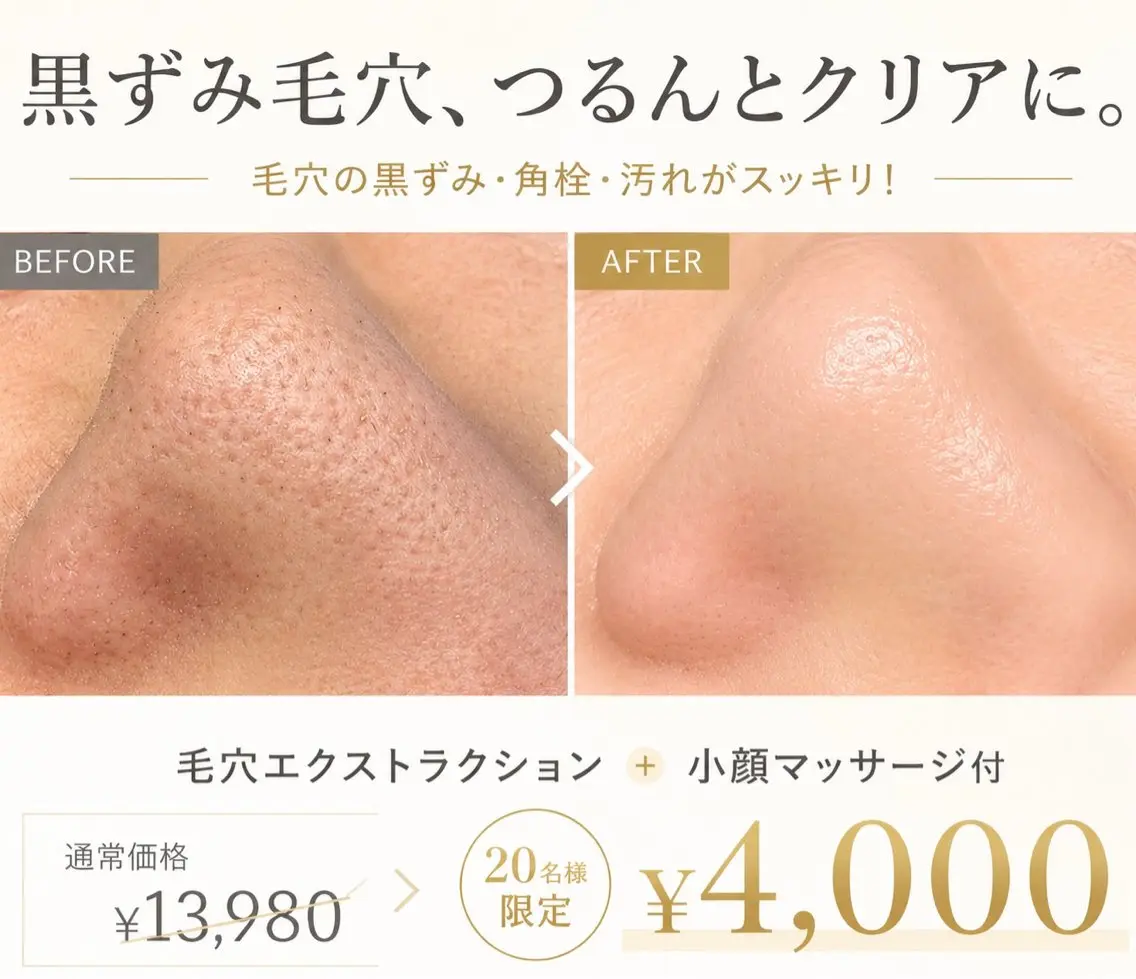 毛穴エクストラクション＋美容液パック付の写真