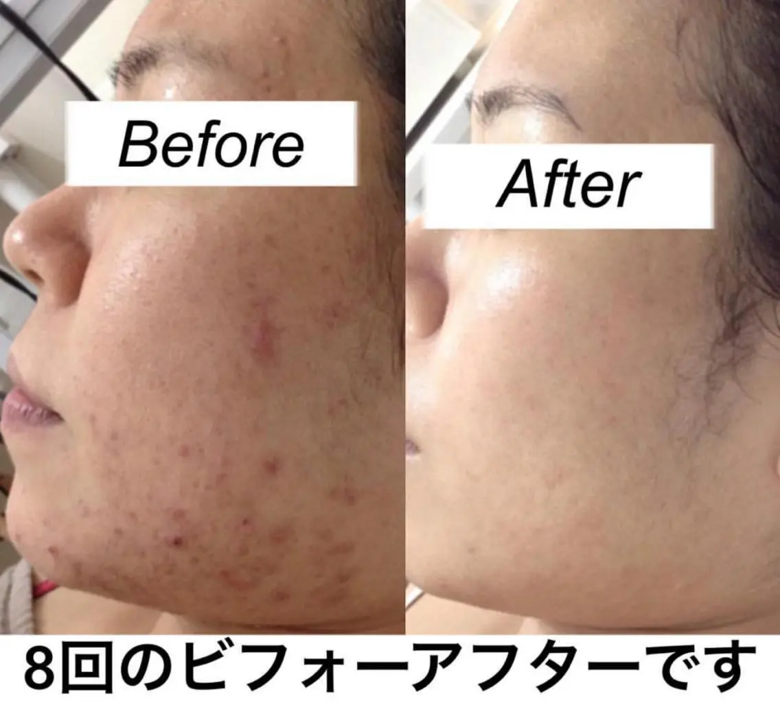 ミディアム カラー パーマ ヘアアレンジ キッズ ネイル マツエク・マツパ エステ リラク 都度払い肌質改善 &脱毛Blancheのエステ・リラクイメージ