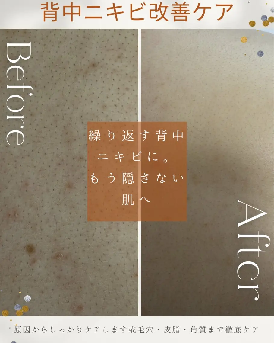 その他 Nature Souce毛穴専門店のその他イメージ