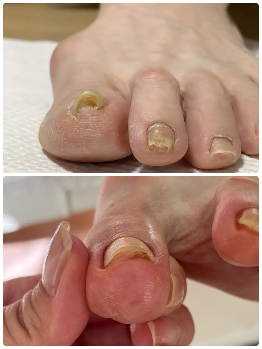 ネイル Alo.nail アロ•ネイルのネイルデザイン