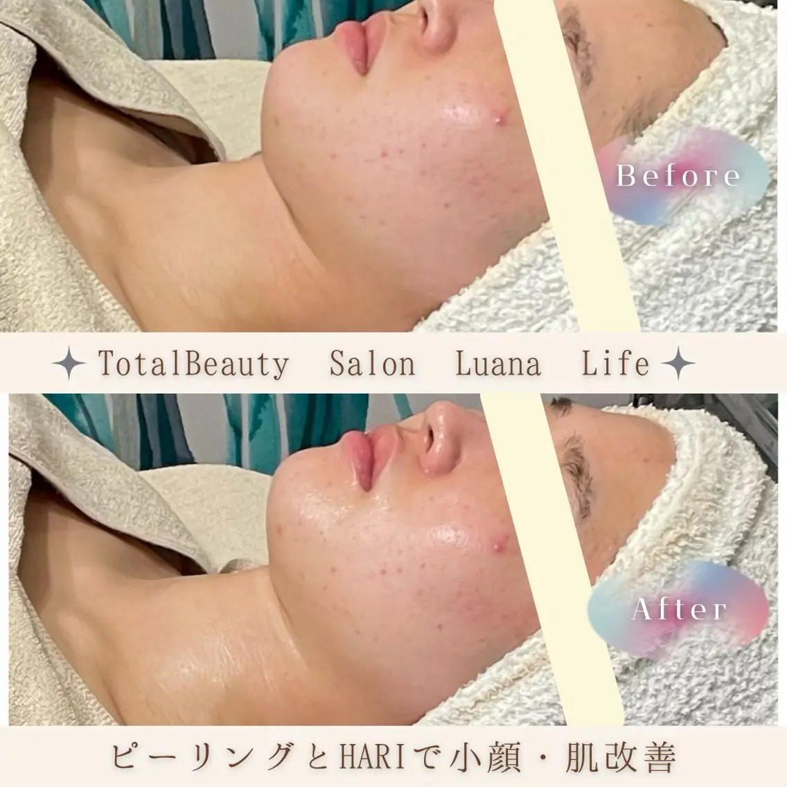肌改善・脱毛・痩身 LuanaLifeのエステ・リラクイメージ