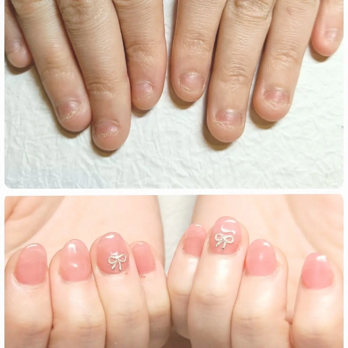 ネイル スカルプネイル ハンドネイル ハンドケア 深爪矯正/爪育成ケア manie nailのネイルデザイン