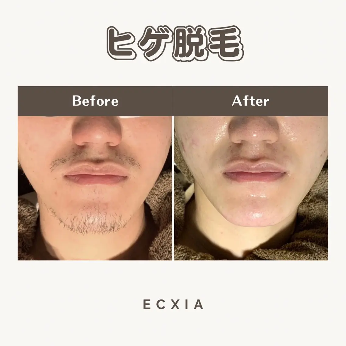 メンズ メンズ脱毛サロン ECXIA 博多のエステ・リラクイメージ