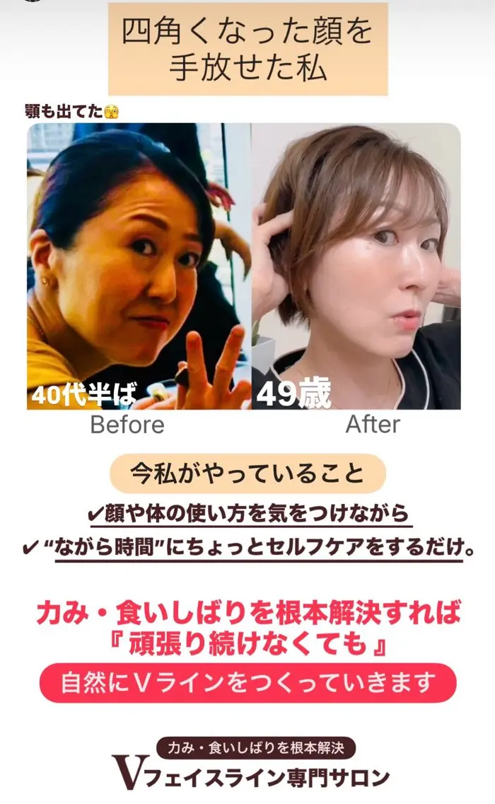 小顔サロン (ラ リュミエール)のエステ・リラクイメージ