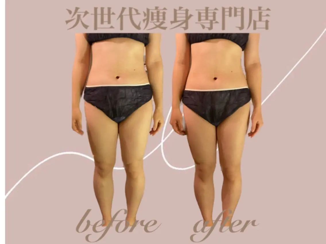 エステ 温活痩身サロン LILYのエステ・リラクイメージ