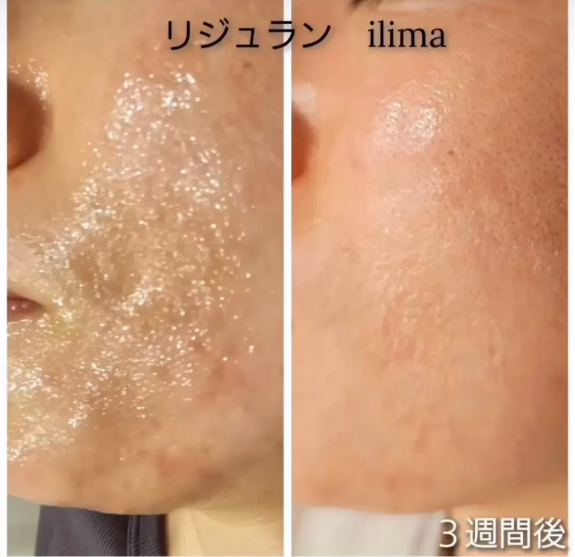 ilima NARUMIのエステ・リラクイメージ