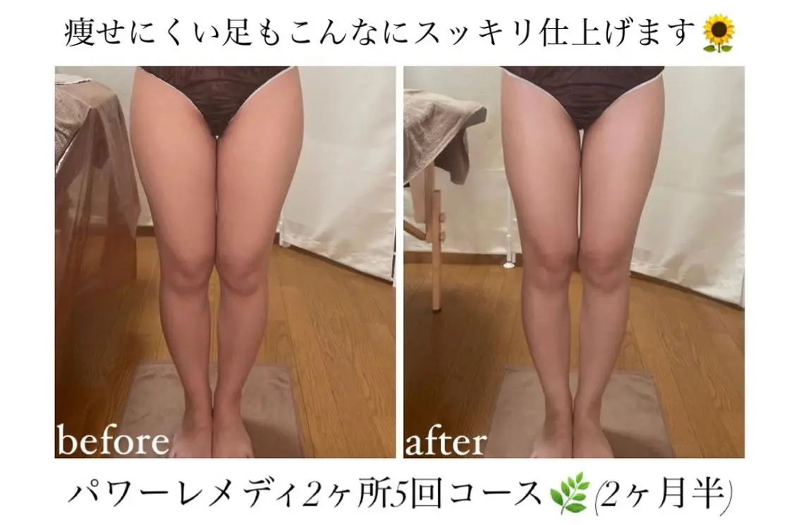 《本気痩せ×疲労改善 》 BILOOPのエステ・リラクイメージ