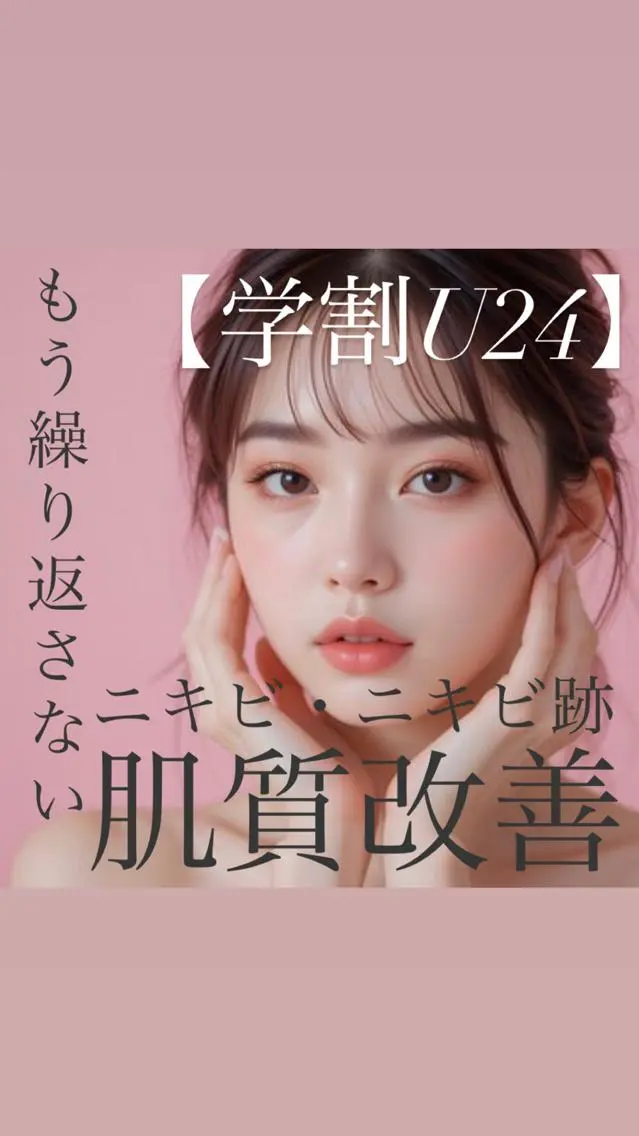 【ミニモ学割U24🏫】ニキビ肌にお悩みの方へ ニキビ・ニキビ跡解消 フォトRF ¥2,980の写真