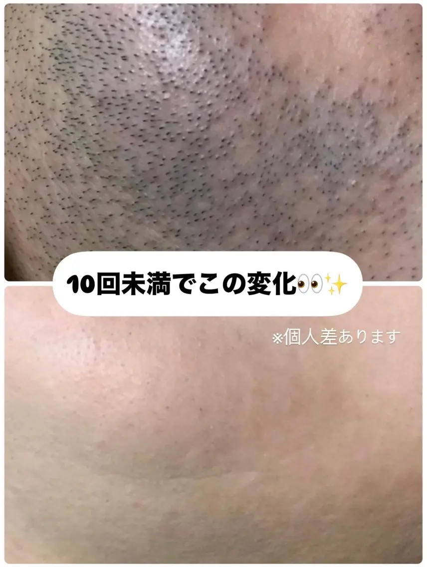 メンズ muumo まりののエステ・リラクイメージ