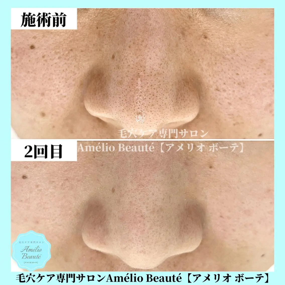 毛穴ケア専門サロン アメリオボーテのその他イメージ