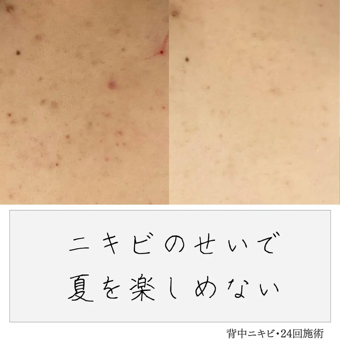 ニキビ経験者が施術 する専門サロン🌻のエステ・リラクイメージ