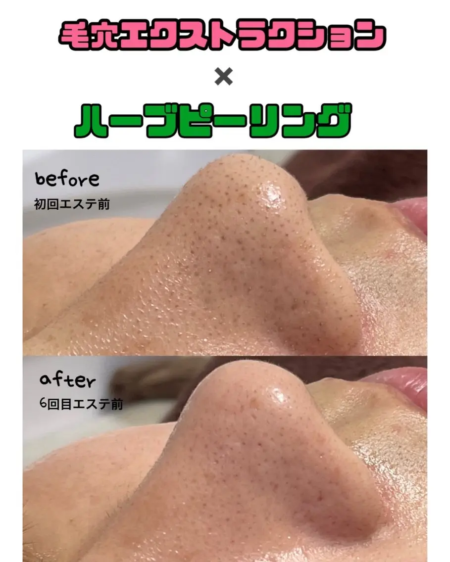 その他 Le'perle｡ Kyokaのエステ・リラクイメージ