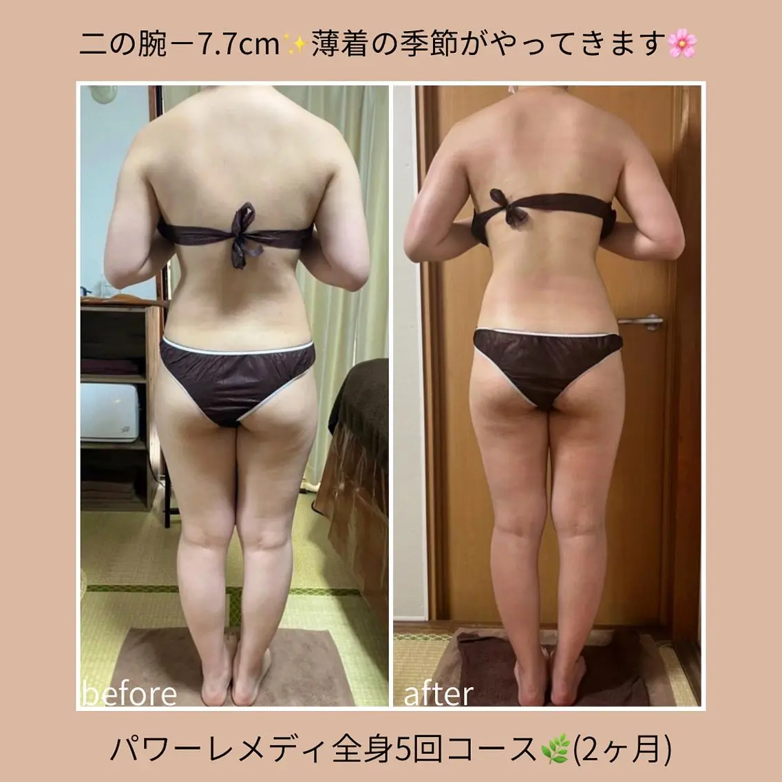 《本気痩せ×疲労改善 》 BILOOPのエステ・リラクイメージ