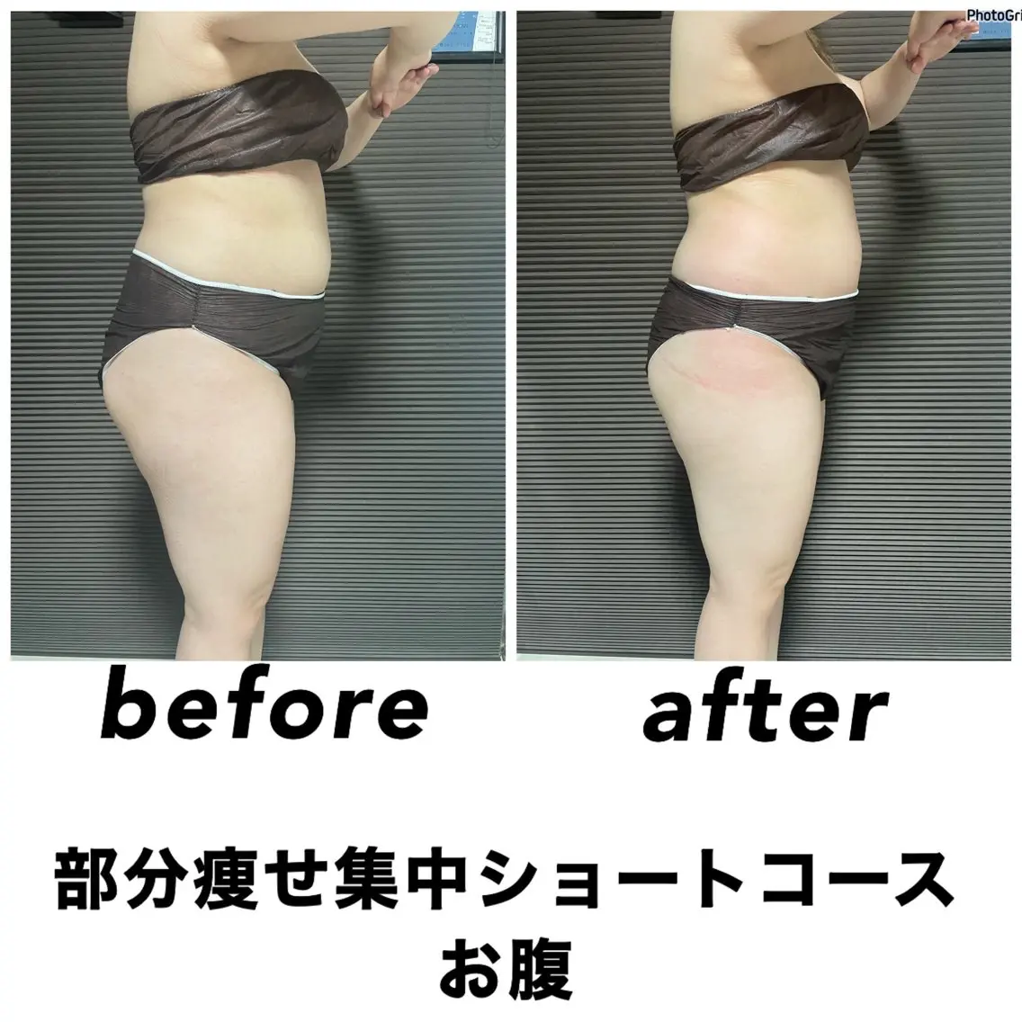 ネイル・エステサロン UILANIのエステ・リラクイメージ