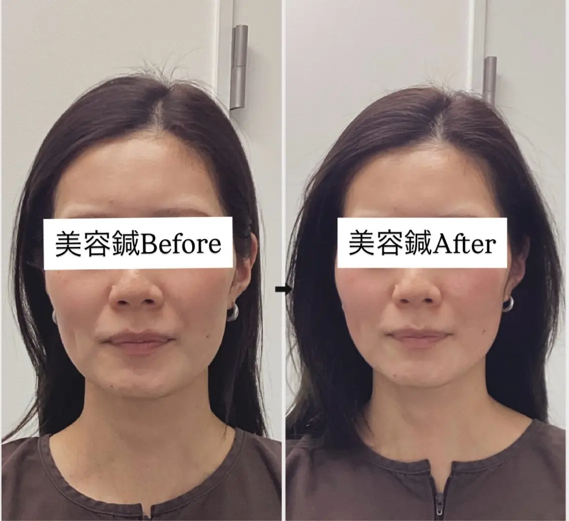 美容鍼灸×小顔整体♡ ハリサロンドオフ堺東のその他イメージ