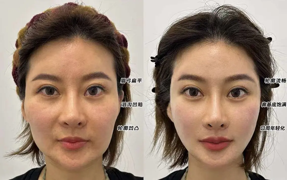 ネイル 愛維美水光専門店 川崎彩鳳のエステ・リラクイメージ
