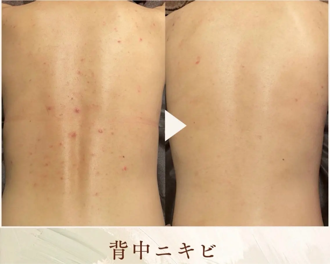 エステ Jewelry bodyのエステ・リラクイメージ