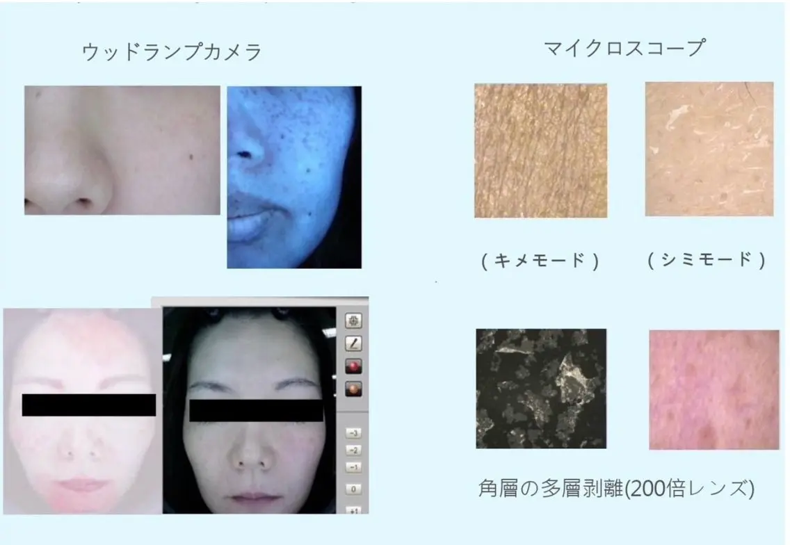 メニューに迷ったらこちら　　　　　　　　　　　　　　　✨お肌カウンセリング✨の写真