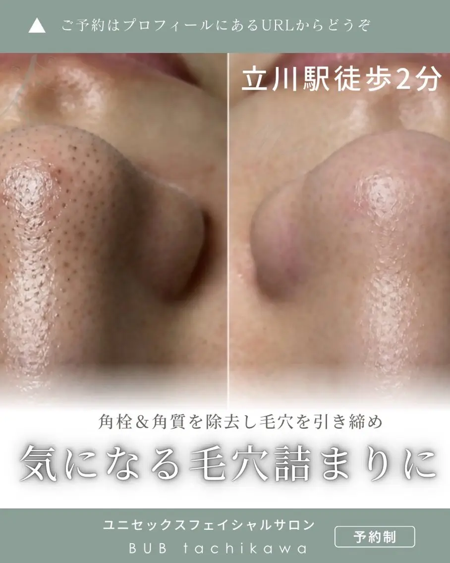 メンズ エステ 【BUB立川】 ゆかのエステ・リラクイメージ