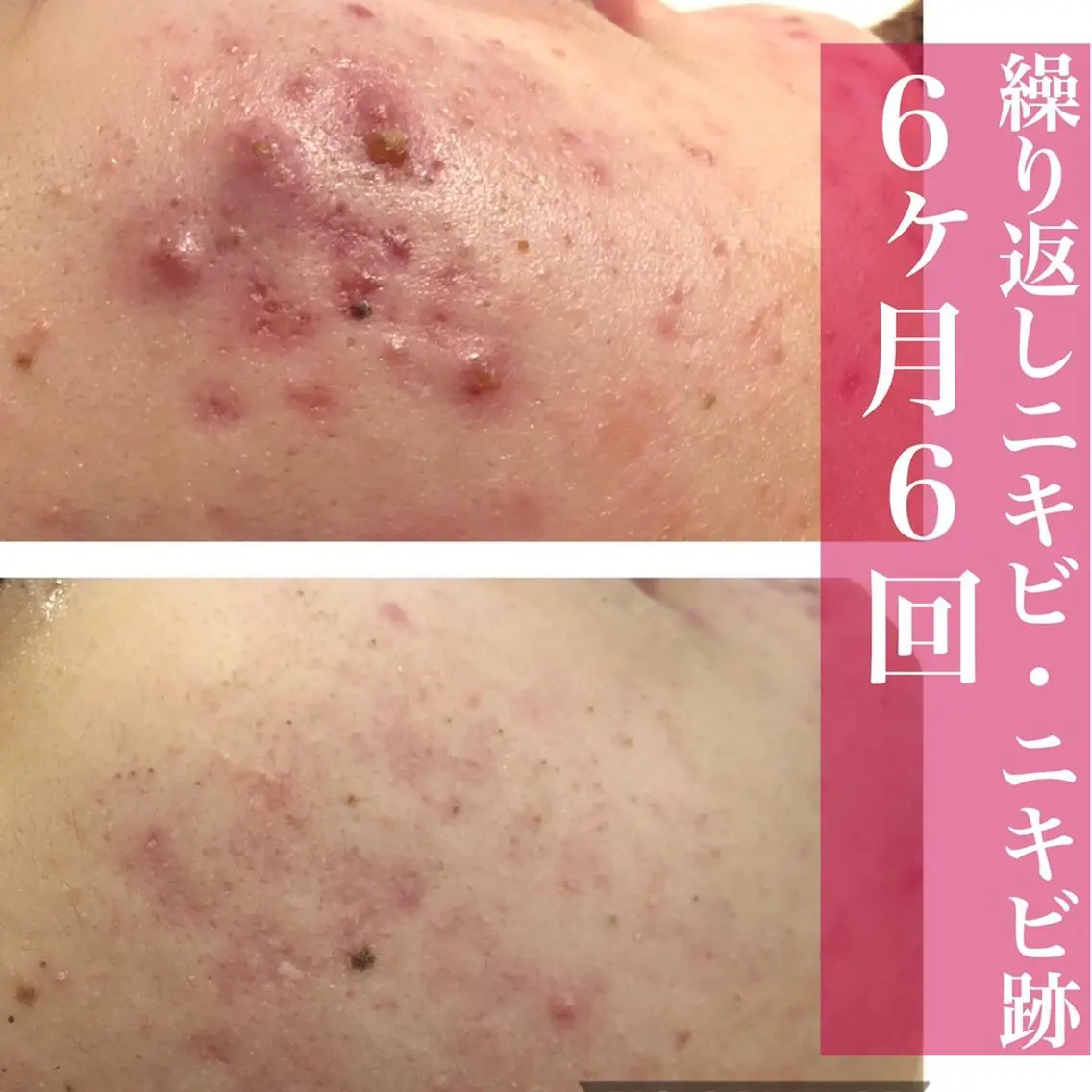 ミディアム カラー パーマ ヘアアレンジ メンズ キッズ ネイル マツエク・マツパ 赤色 エステ リラク ニキビ・肌質改善専門 ♡人生が変わるサロンのエステ・リラクイメージ