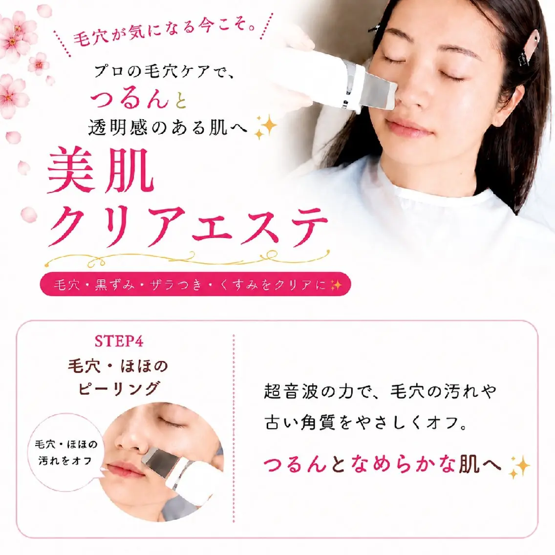 毛穴つるん♪超音波ピーリングエステの写真
