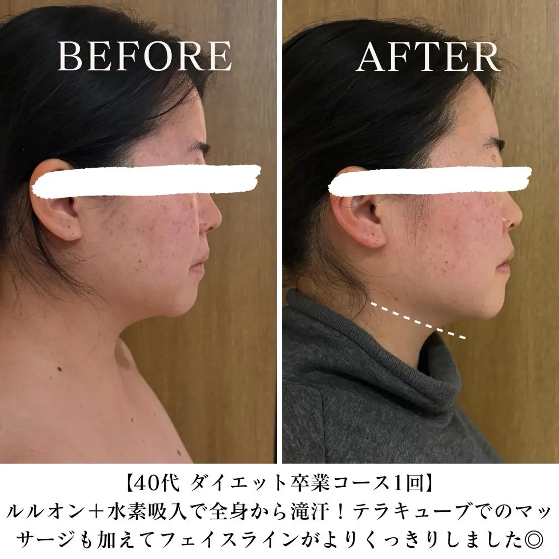 【三軒茶屋/下馬】 本格痩身・よもぎ蒸しのエステ・リラクイメージ